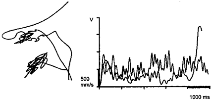 Meinrad Perrez "Lehrbuch Klinische Psychologie Psychotherapie"