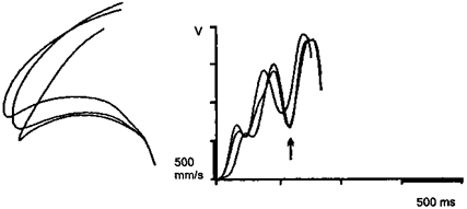Meinrad Perrez "Lehrbuch Klinische Psychologie Psychotherapie"