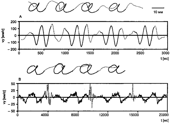 Meinrad Perrez "Lehrbuch Klinische Psychologie Psychotherapie"
